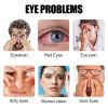South Moon Wormwood Eye Care Sticker Box, Stay Up Late Eye Dry Eye Astringent Cold Compress Stick Moxibustion Students Eye Care Patch Vision